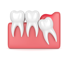 West Chicago Smiles | Veneers, Preventative Program and Botox reg