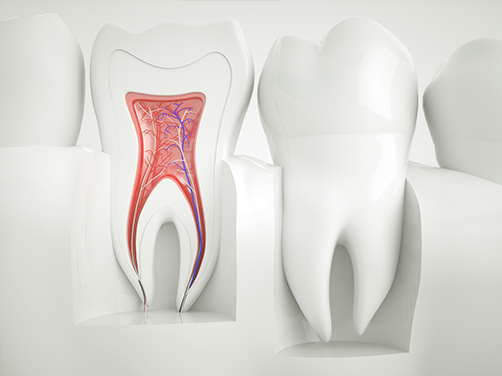 West Chicago Smiles | Night Guards, Air Abrasion and Fluoride Treatment