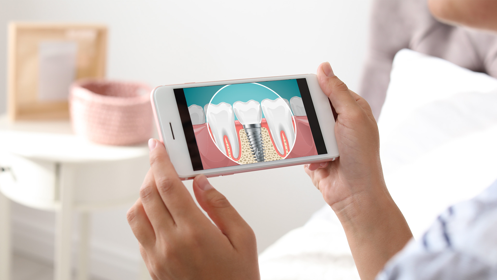 A person holding a smartphone displaying an image of a tooth with a dental implant and gum tissue.