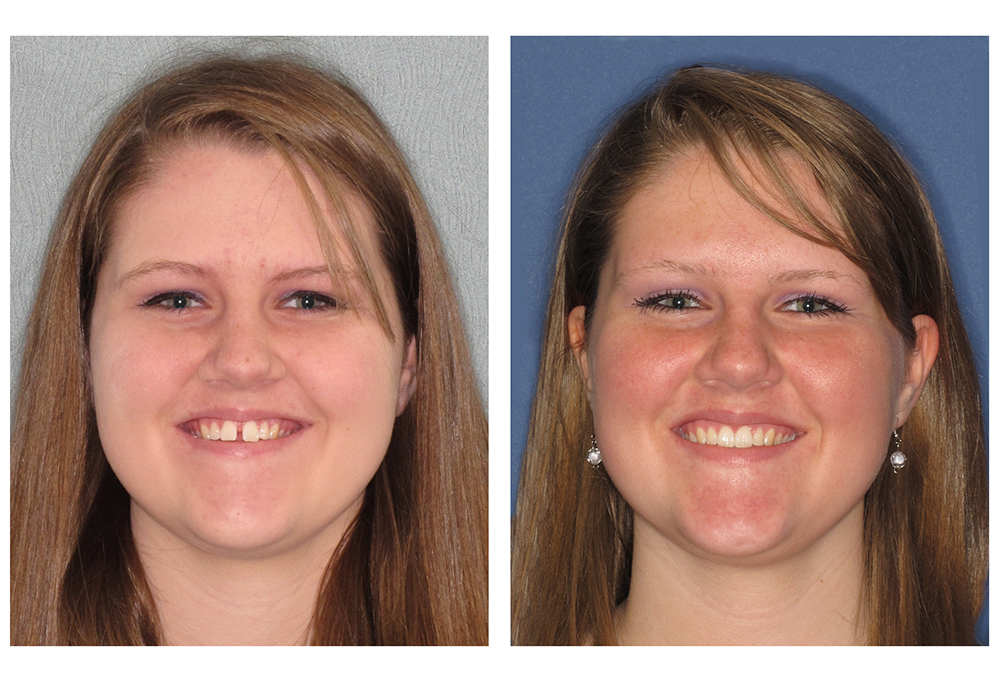 West Chicago Smiles