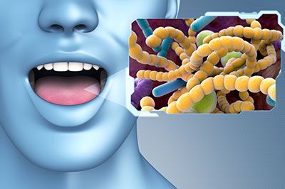 A digital illustration featuring a humanoid figure with an open mouth, displaying teeth and gums, against a blue background. To the right of the figure is a graphic representation of bacteria or microorganisms, predominantly yellow and green, with some red elements.