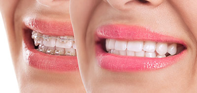 The image is a split-screen photograph featuring two different perspectives of the same woman s face. One side shows her smiling and looking directly at the camera, while the other displays her profile with a bright pink lipstick accentuating her lips.