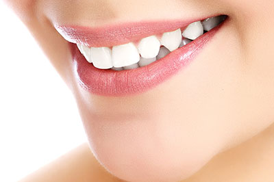 The image displays a close-up of a person s smiling face, focusing on their teeth and lips.