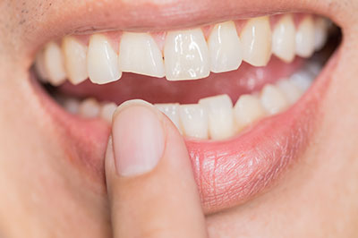 The image shows a close-up of a person s mouth with a focus on their teeth and lips, with a finger holding a toothpick.