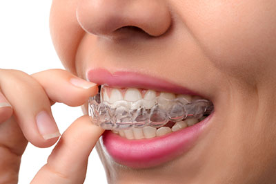 The image shows a person s hand holding a clear braces wire, with the person wearing a full set of white braces and smiling.