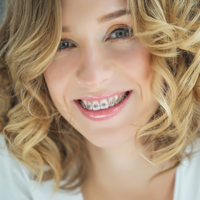 West Chicago Smiles | Dermal Fillers, Dental Bridges and All-on-6 reg 