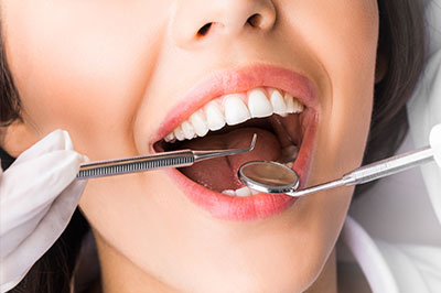 The image shows a woman with her mouth open, surrounded by dental tools, indicating a dental care or oral health theme.