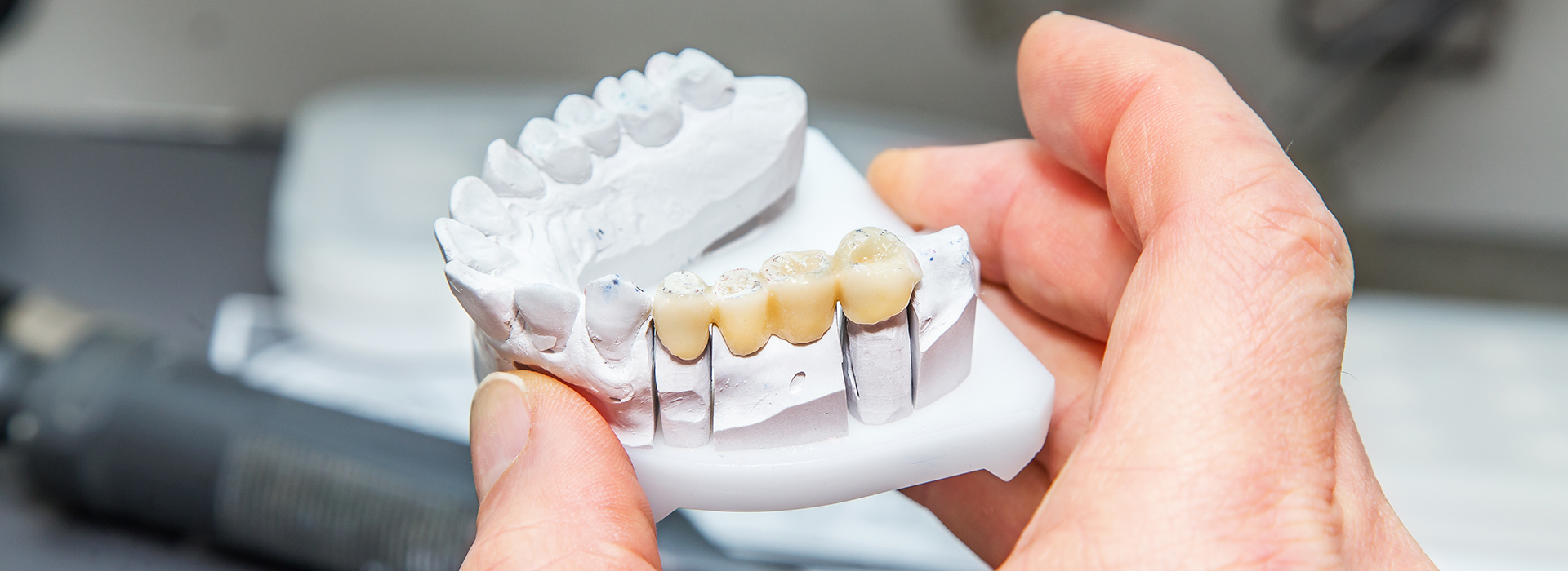 An individual s hands holding a white, 3D printed dental model.