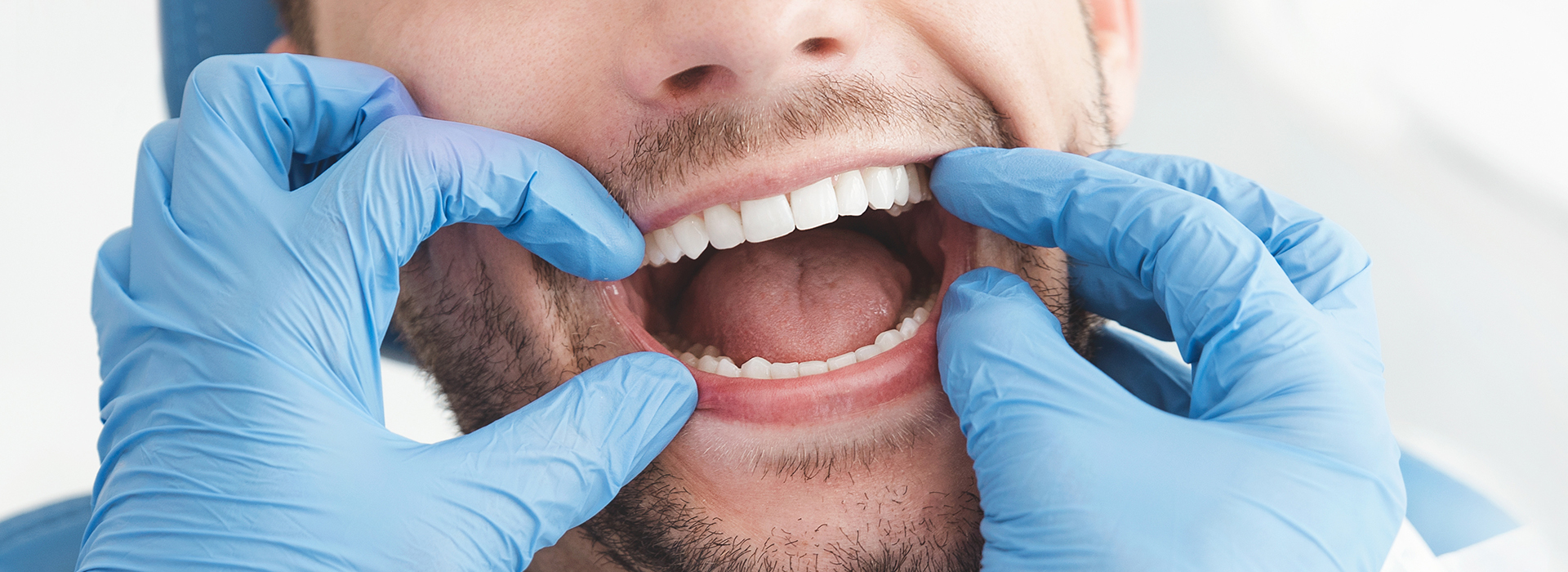 The image shows a man with his mouth open, being attended to by a dental professional wearing blue gloves and a face mask.