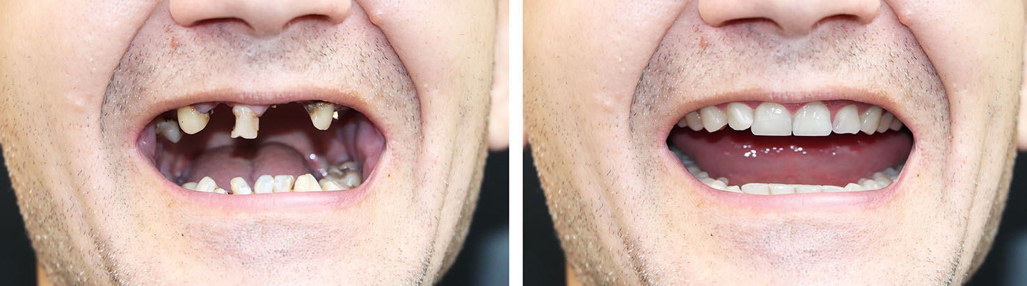 West Chicago Smiles | Dentures, Extractions and Cosmetic Dentistry