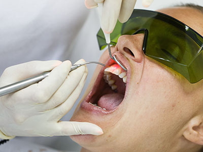 A person receiving dental treatment, with a dentist performing the procedure and a medical mask on their face.